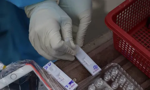 Các bước tự test nhanh Covid-19 tại nhà
