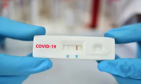 Những sai lầm khi tự lấy mẫu test nhanh tại nhà