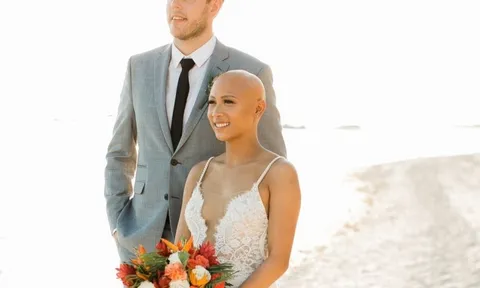 Độc đáo: Những cô dâu khoe đầu trọc trong đám cưới