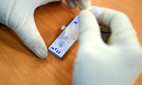 Lấy 1,4 triệu test nhanh, TP.HCM phát hiện hơn 54.000 mẫu dương tính