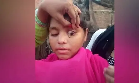 Chuyện lạ: Thiếu nữ 15 tuổi ở Ấn Độ 'khóc ra đá' suốt 2 tháng