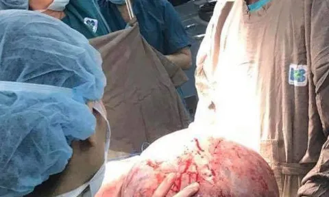 Cô gái mắc bệnh kỳ dị nhất thế giới  được phẫu thuật thành công