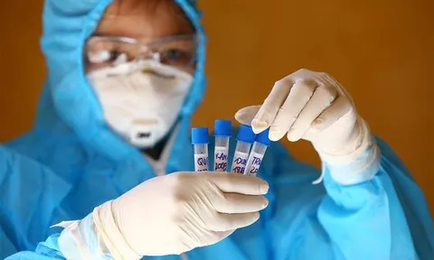 Sáng 9/8, Việt Nam có thêm 2 ca mắc mới COVID-19, trong đó 1 ca tại Hà Nội